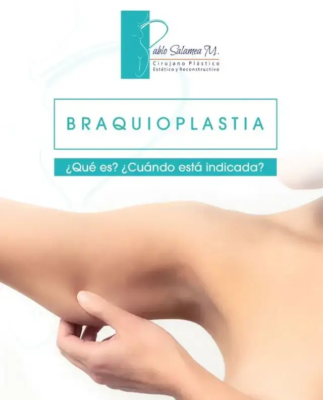 Braquioplastia o lifting de brazos en la ciudad de Cuenca con el Dr. Pablo Salamea especialista en cirugía plástica.