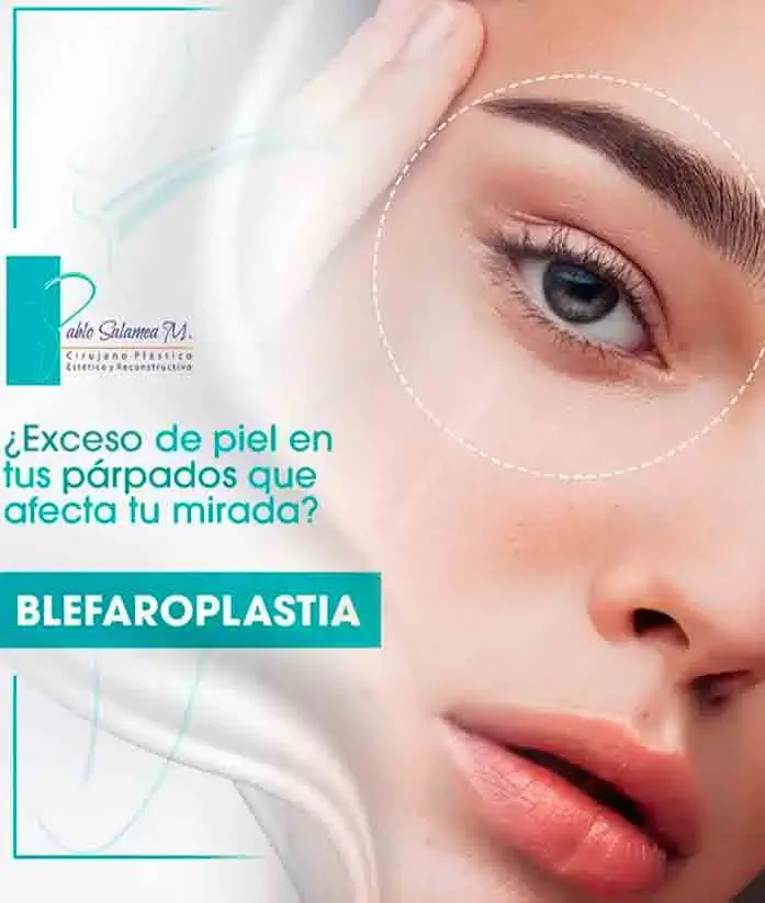 blefaroplastia en Cuenca, cirugía de párpados Ecuador, rejuvenecimiento facial, cirujano plástico experto