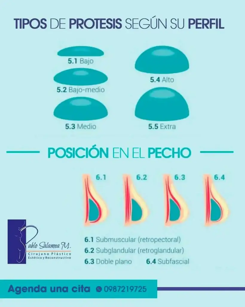 tipos de protesis, cirujano plástico